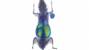 Glowing Tumors Reveal How Immunotherapeutics Work | Drug Discovery And Development