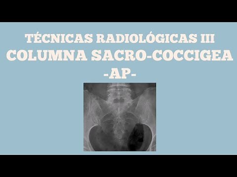 Proyección AP de columna sacro-coccigea