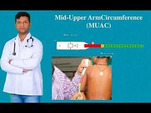 MUAC (Mid Upper Arm Circumference)