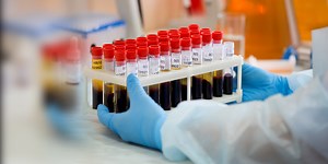 Blood Grouping what are the most common and rare blood groups by percentage in India