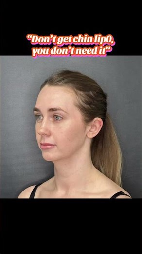 Chin Lipo and Renuvion Skin Tightening | Before and After