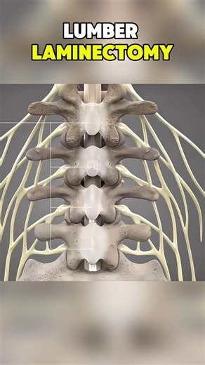 79K views · 573 reactions | Ever wondered how doctors treat back pain?| | Donnallyspineconsult | Facebook