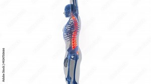 Human Suffering with Backache in Spinal Cord Anatomy Animation Concept
