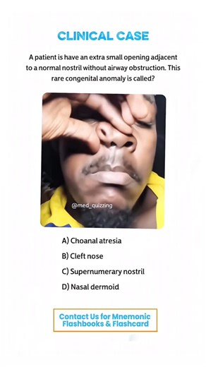 𝑴𝒆𝒅 𝑸𝒖𝒊𝒛𝒛𝒊𝒏𝒈 on Instagram: "Comment “Details” and check your inbox for the full mnemonic flashbook & flashcards! 📕✨ . . . . . . #medical #medicine #medicalstudent #medicinestudent #usmle #step1 #plab #mrcp #medicine #reels #viral #foryou #anatomy #reelexplore #instagram #neurology #nephrology #surgery #students #colleges #cardiology #knowledge #virals #plab #UK #USA #newyork #nyc #neet"