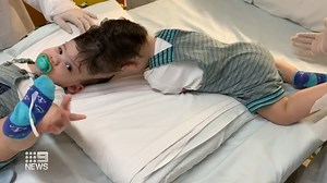 96K views · 3.7K reactions | In a feat for medical science, surgical teams spanning the globe have managed to separate conjoined twins whose brains were fused together. #9News | WATCH LIVE 6pm | 9 News | Facebook