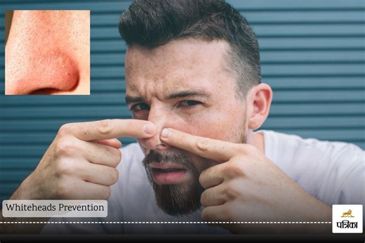 Whiteheads Prevention: क्या आप जानते हैं, आखिर नाक पर व्हाइटहेड्स क्यों होते हैं और इसके बचाव में क्या करना चाहिए?