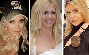 En Cortá por Lozano revelaron que Wanda Nara se realizó una cirugía estética: “Ella lo niega pero todos se dieron cuenta”