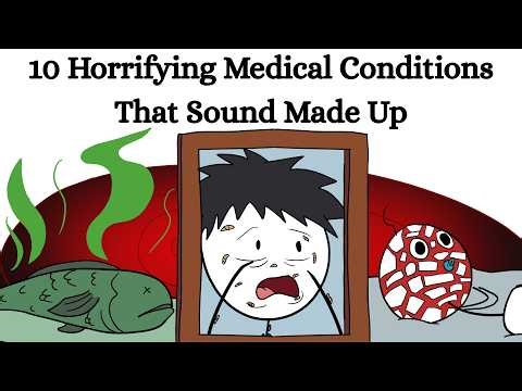 10 Horrifying Medical Conditions That Sound Made Up