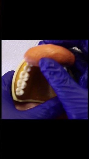 PUTTY l PVS Impression #science #dentalprosthesis #biology #dentistry