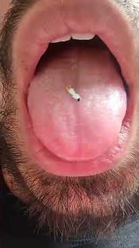 Hungry giant (MALE GIANT)