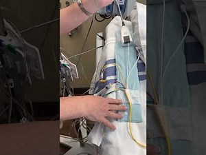 Swan (Pulmonary Artery Catheter) setup for CABG patient