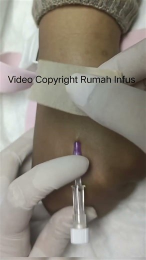 IV Cannulation | IV Injection | IVDrips