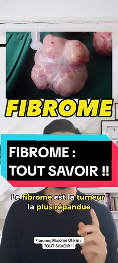 Fibrome Utérin : Causes, Symptômes et Traitements