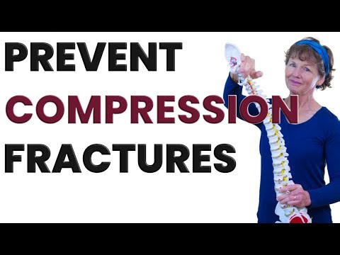 Prevent Compression Fractures: Exercises and Supplements