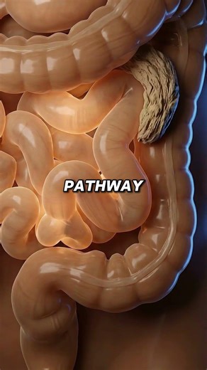 This Toilet Position Fixes Constipation Instantly 🚽🧠 #ConstipationRelief #GutHealth