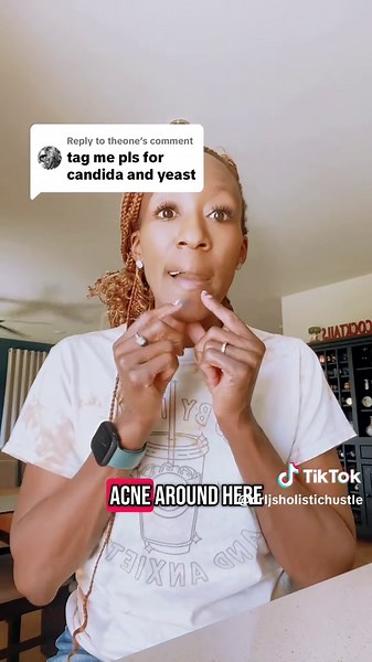 How to Treat Candida and Fungal Acne Effectively