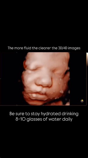 New Life Ultrasound®️ on Instagram: "A little tip for clear 3D/4D ultrasound images 👶🏻👶🏻👶🏻 Drinking 8-10 glasses of water daily will help set the stage for the ultimate clarity. 💧🥤"