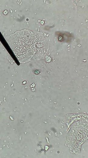 Trofozoítos Trichomonas vaginalis | Trichomonas vaginalis trophozoites #microbiologist