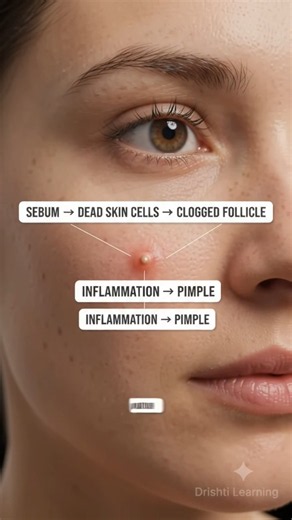 What REALLY Happens Inside Your Skin When You Get a Pimple? 😳🧬