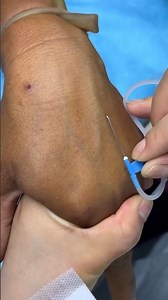 The Ultimate Guide to IV Injection Needle Sizes NCLEX Nursing Training: N10