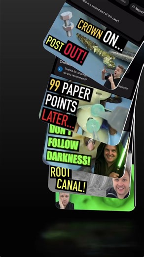 Biodentine Pros & Cons of Perforation Repair Explained