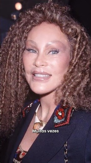 Jocelyn Wildenstein: quando a cirurgia muda demais o rosto