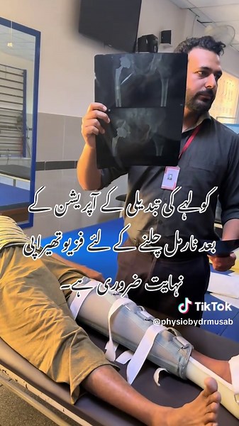 Essential Physiotherapy After Total Hip Replacement Surgery