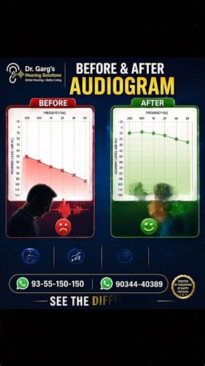 Don't ignore these hearing loss warning signs #hearinghealth #audiology #shorts