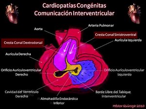Embryology of the interventricular septum