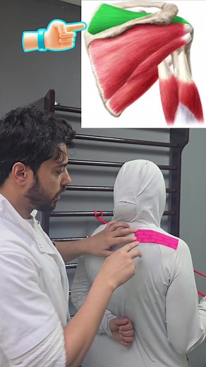 علاج ألم الكتف: شرح التهاب عضلة Supraspinatus