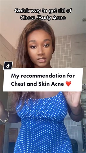 Effective Ways to Clear Chest Acne and Achieve Clear Skin
