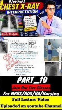 PART_10 Learn Normal Chest X-Ray Interpretation in a simple, systematic way!