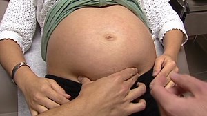 BMI affects pregnant women