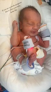 If you are 33 weeks pregnant this is what your baby looks like #33weeks #33weekspregnant #nicubaby #pregnant #foryoupage | Nicu baby