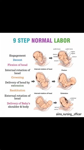Nursing & Medical Profession 🔵 on Instagram: "The 9 Steps of Normal Labor: A Beautiful, Natural Process 🤱✨ Witnessing how your baby navigates the birth canal is a testament to nature’s incredible design. Labor isn't just about contractions—it’s a precise, step-by-step dance between your body and your baby. Here’s a look at the miraculous journey of a vaginal birth: 1. Engagement ➡️ 2. Descent Your baby’s head settles into your pelvis, preparing for the journey ahead. They begin to move down, l