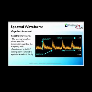 Let's talk #ultrasoundphysics - Learn about #spectraldoppler with this quick talk on Spectral Doppler Analysis and Doppler Waveforms. This is an excerpt from one of our CME Courses, approved for SDMS CME Credit. With our easy to follow, simple presentation style audio format, we make it simple and convenient to get the CME's you need on the go. Get your CME's - study with us today! #allaboutultrasound #ultrasound #sonography #sonography101 #meanwhileinultrasound #ultrasoundregistryreview #allbou