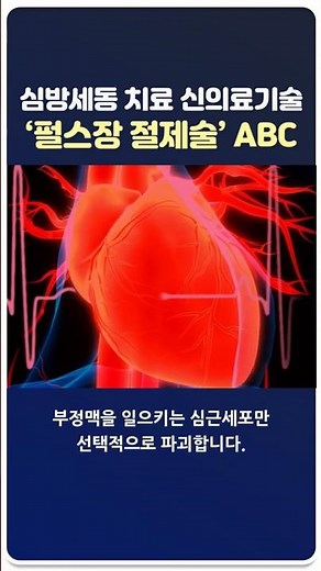 #shorts A new medical technology, ‘Pulsed Field Ablation’, is here! A new treatment for atrial fi...