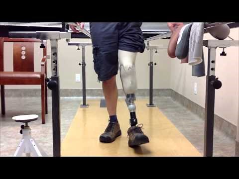 Dynamic Alignment | limb-loss.org