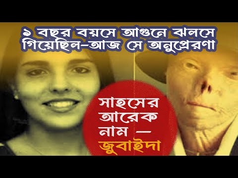 জুবাইদার গল্প – আগুন থেকে ফিরে আসা এক অলৌকিক জীবন🔹 Zubaida Hasan – Real Burn Survivor True Story |