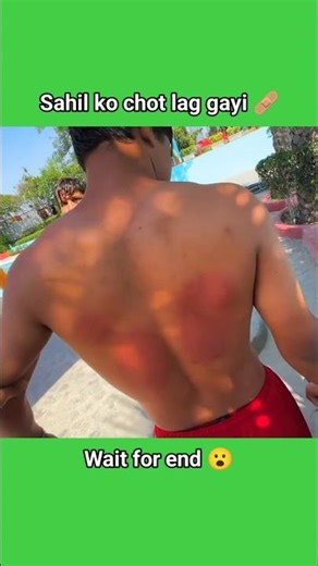 Sahil ko chot lag gayi 🩹 ll sourav joshi vlogs ll #shorts #youtubeshorts