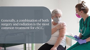 5 treatment options for cutaneous squamous cell carcinoma - Sharecare