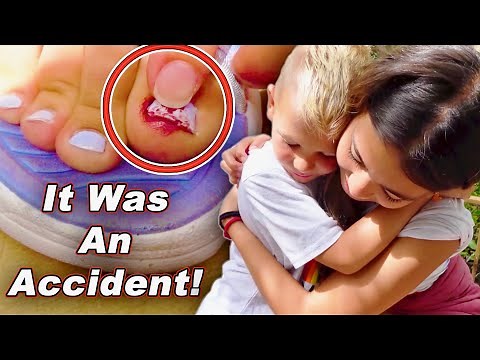 Ripped Her Toe Nail Off!