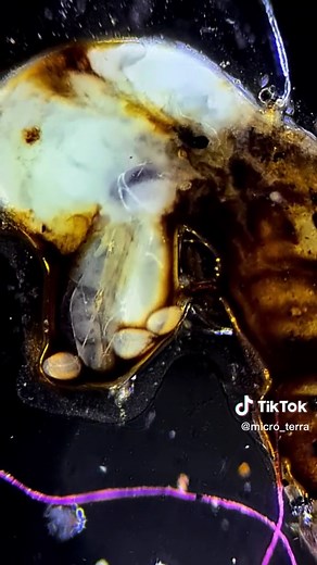 Observación de Mosquitos bajo el Microscopio