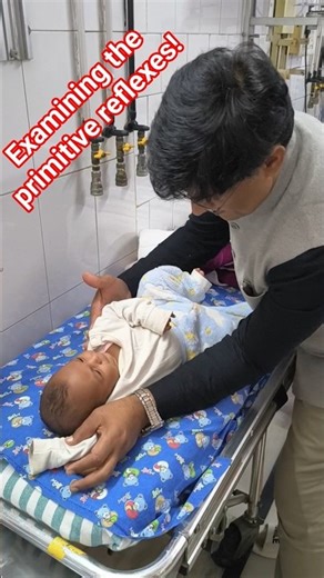 Examining Primitive reflexes #cutebaby #shots