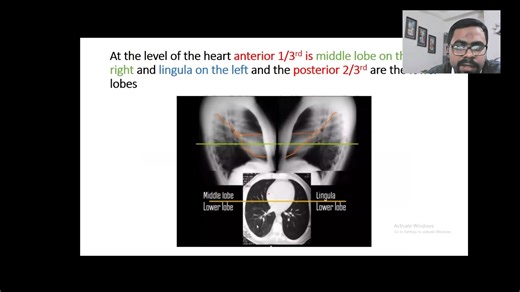 CT scan of chest part-1 #CT #CTscan #CTChest #radiology | Med Theory
