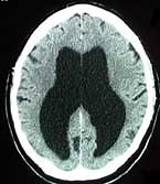 DARPA spies on analyst brains; hopes to offload image analysis to computers