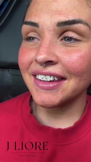 This tooth gem design is everything!! 🤩🖤 So stunning ✨ Enjoyed every minute creating this. #sparklebymaya #toothgem #sparkle #shine #ToothGems #ToothGemArt #SmileBright #GemTeeth #SparklingSmile #ToothJewels #CrystalTeeth #GemstoneSmile #ShinyTeeth #ToothGemTrend #LuxurySmile #ToothGemAccessories #TeethDecoration #JewelledTeeth #CustomToothGems #SmileGoals #GlowUp #ConfidenceBoost #BeautyTips #SelfCare #MakeYourSmilePop #GlamSmile #SmileMakeover #DentalCare #FreshSmile #CosmeticDentistry #Heal