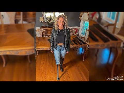 Woman with amputated legs walking with prosthetic legs #amputee