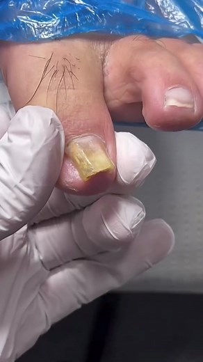 Doctor Nail នៅលើ TikTok