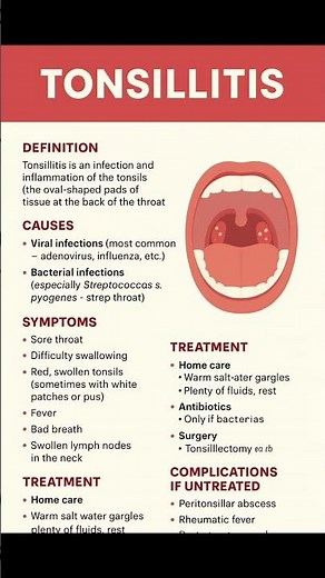 📌 Tonsillitis Explained | Symptoms, Causes & Treatment
